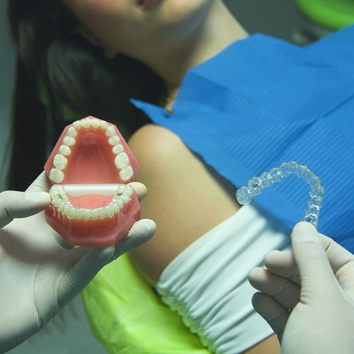 ortodonzia invisibile anteprima