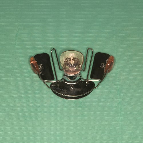 ortodonzia anteprima